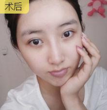 去眼袋手术
