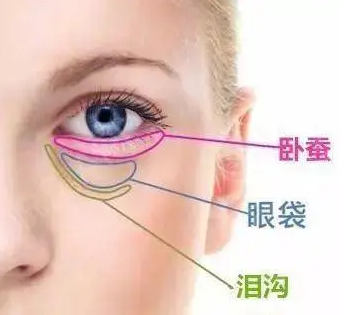 去眼袋手术