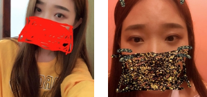 去眼袋手术