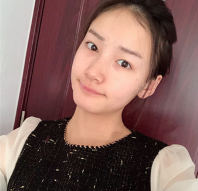 双眼皮手术