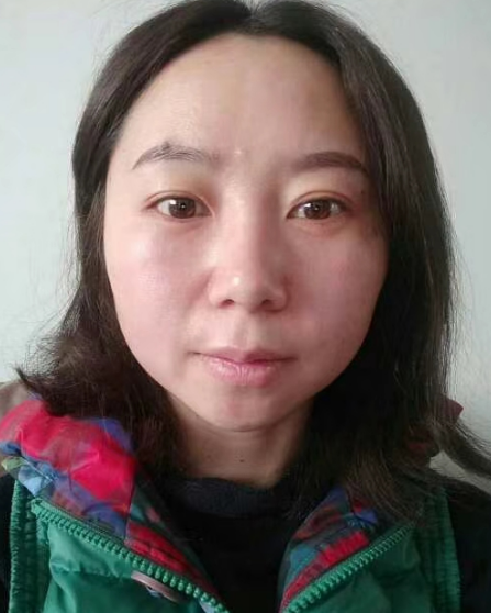 去眼袋手术