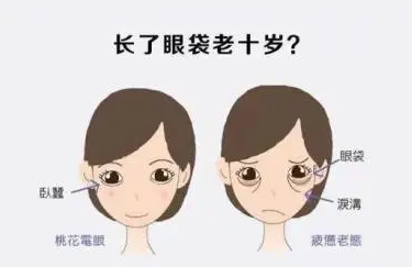 去眼袋手术