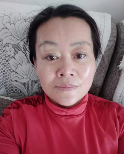 去眼袋手术
