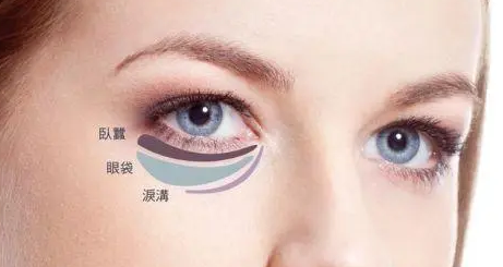 去眼袋手术