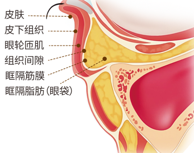 去眼袋手术