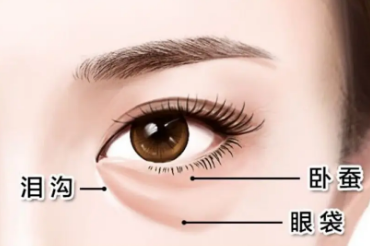 去眼袋手术