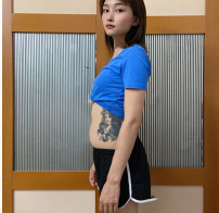 超声波减肥