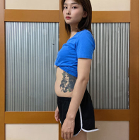 超声波减肥