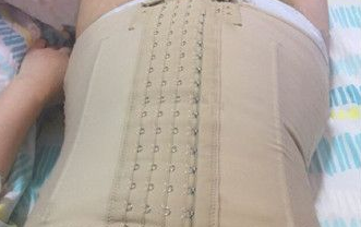 超声波减肥
