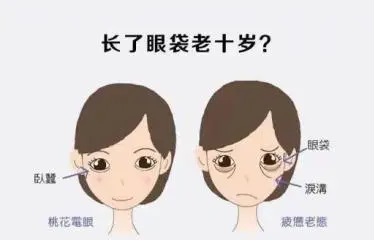 去眼袋手术