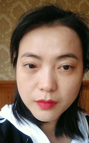 去眼袋手术