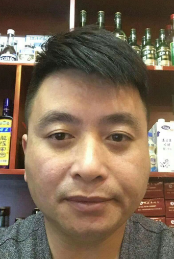 去眼袋手术