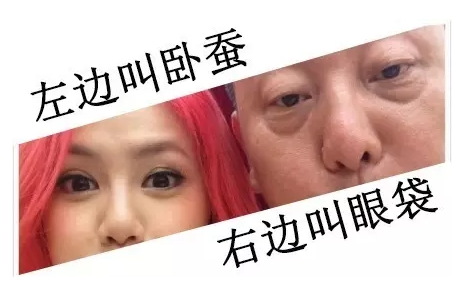 去眼袋手术