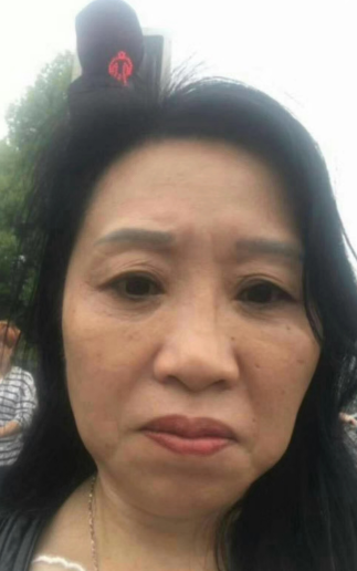 去眼袋手术