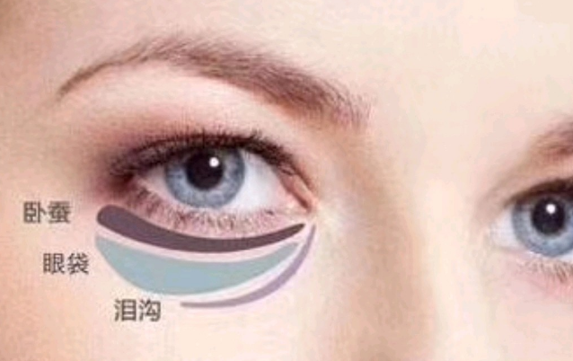 去眼袋手术