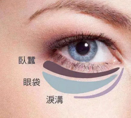去眼袋手术
