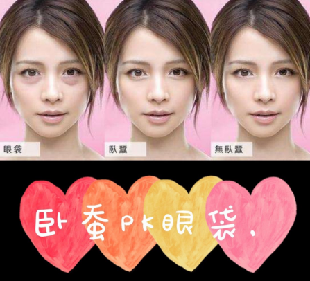 去眼袋手术