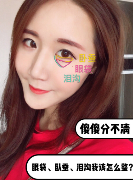 去眼袋手术