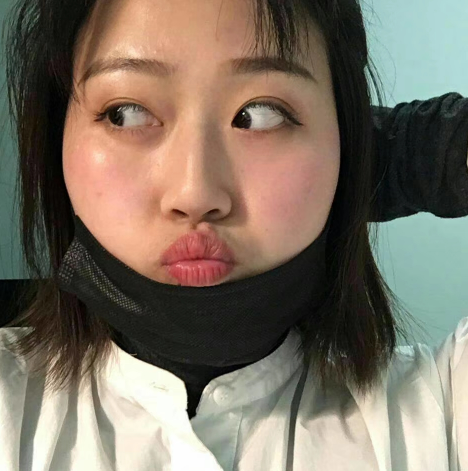 去眼袋手术