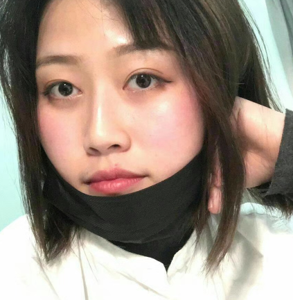 去眼袋手术