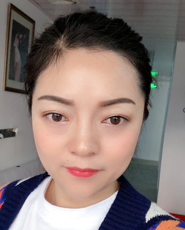 去眼袋手术