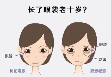 去眼袋手术