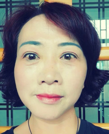 去眼袋手术