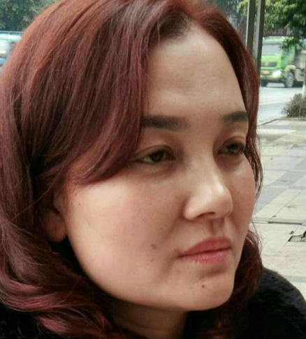 去眼袋手术