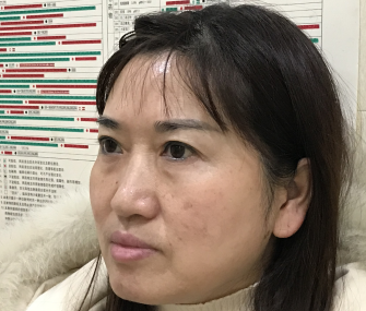去眼袋手术