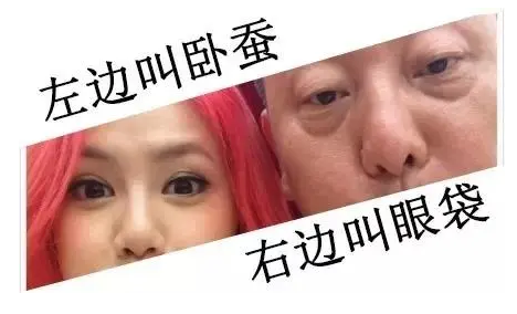 去眼袋手术