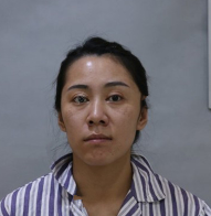 去眼袋手术