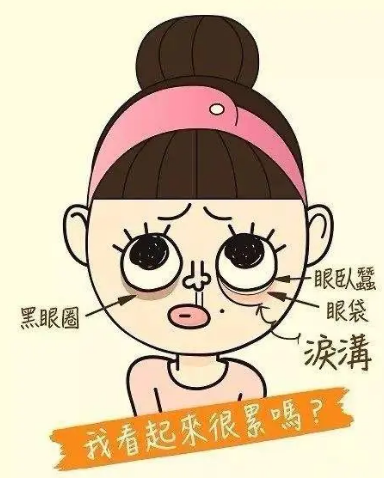 去眼袋手术
