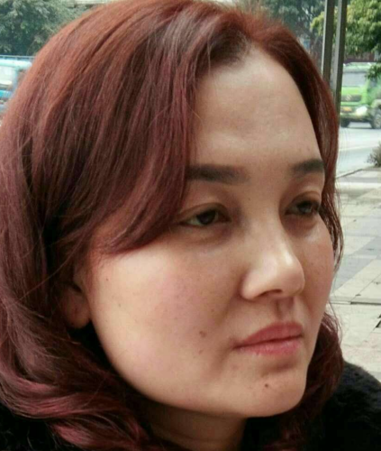 去眼袋手术