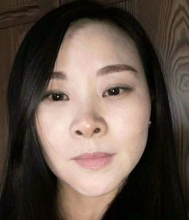 去眼袋手术