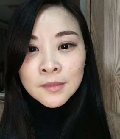 去眼袋手术