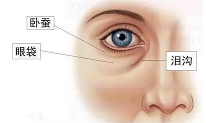 去眼袋手术