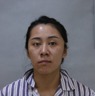 去眼袋手术