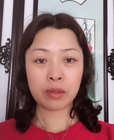 去眼袋手术