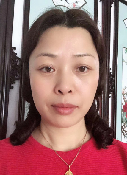 去眼袋手术