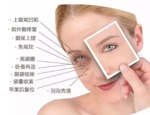 去眼袋手术