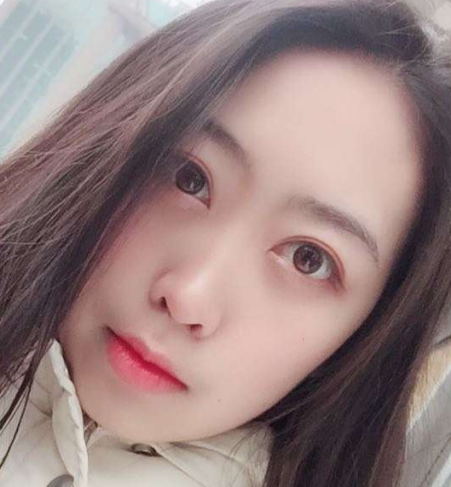 去眼袋手术
