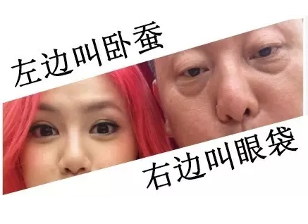 去眼袋手术