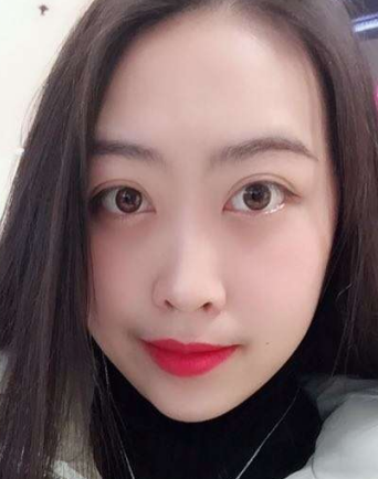 去眼袋手术