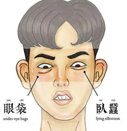 去眼袋手术