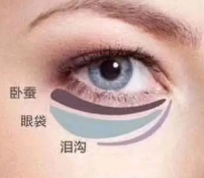 去眼袋手术
