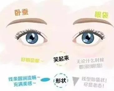 去眼袋手术