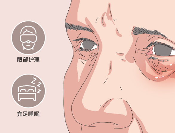 去眼袋手术