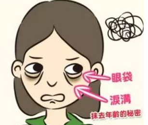 去眼袋手术