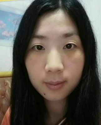 去眼袋手术