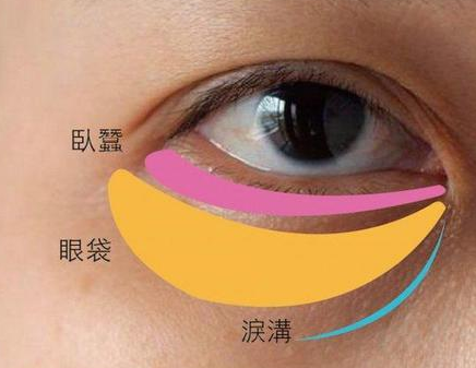 去眼袋手术